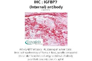 Image no. 2 for anti-Insulin-Like Growth Factor Binding Protein 7 (IGFBP7) (Internal Region) antibody (ABIN1735789) (IGFBP7 antibody  (Internal Region))