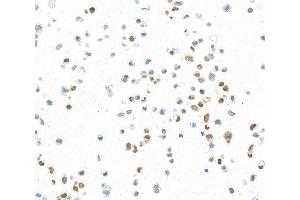 Immunocytochemistry (ICC) image for anti-Forkhead Box Q1 (FOXQ1) (AA 353-403) antibody (ABIN7455177)