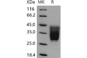 Western Blotting (WB) image for CD99 Molecule-Like 2 (CD99L2) (Active) protein (His tag) (ABIN7320248) (CD99L2 Protein (His tag))