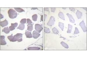 Immunohistochemistry analysis of paraffin-embedded human skeletal muscle, using AMPK beta1 (Phospho-Ser181) Antibody. (PRKAB1 antibody  (pSer182))