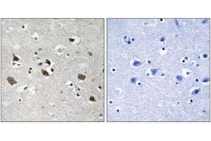 Immunohistochemistry analysis of paraffin-embedded human brain, using SLP-76 (Phospho-Tyr128) Antibody. (LCP2 antibody  (pTyr128))