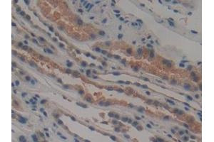 Detection of TTK in Human Kidney Tissue using Polyclonal Antibody to TTK Protein Kinase (TTK)