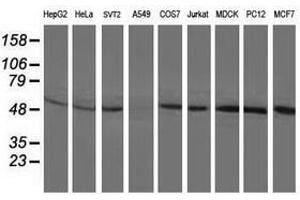 Image no. 2 for anti-Beclin 1, Autophagy Related (BECN1) antibody (ABIN1496867) (Beclin 1 antibody)