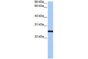 WB Suggested Anti-CCDC46 Antibody Titration: 0. (CCDC46 antibody  (C-Term))