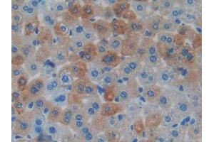 Detection of MAPT in Mouse Liver Tissue using Polyclonal Antibody to Tau Protein (MAPT) (tau antibody  (AA 92-400))