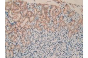Detection of PLXNB1 in Mouse Kidney Tissue using Polyclonal Antibody to Plexin B1 (PLXNB1) (PLXNB1 antibody  (AA 1598-1849))