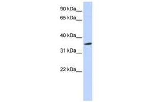 Image no. 1 for anti-Septin 12 (Sep12) (AA 180-229) antibody (ABIN6741160) (Septin 12 antibody  (AA 180-229))