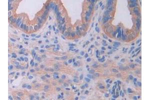 IHC-P analysis of Mouse Uterus Tissue, with DAB staining. (IL18RAP antibody  (AA 396-548))