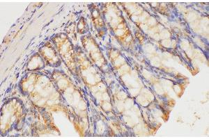 Immunohistochemistry of paraffin-embedded Mouse colon using HRAS Polycloanl Antibody at dilution of 1:200 (HRAS antibody)