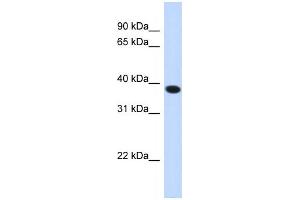 Western Blotting (WB) image for anti-Acyl-CoA Binding Domain Containing 4 (ACBD4) antibody (ABIN2459337) (ACBD4 antibody)