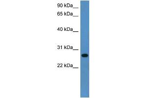 Rat Lung; WB Suggested Anti-Cyb5r2 Antibody Titration: 0. (CYB5R2 antibody  (C-Term))