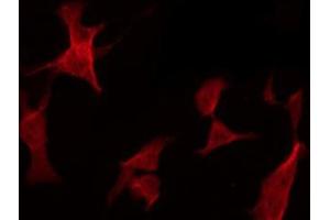 ABIN6278595 staining HepG2 by IF/ICC. (Neurofibromin 1 antibody)