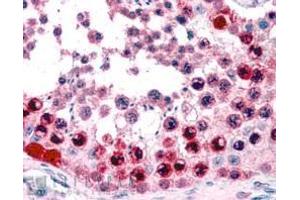 ABIN184653 (3. (ATF7 antibody  (C-Term))