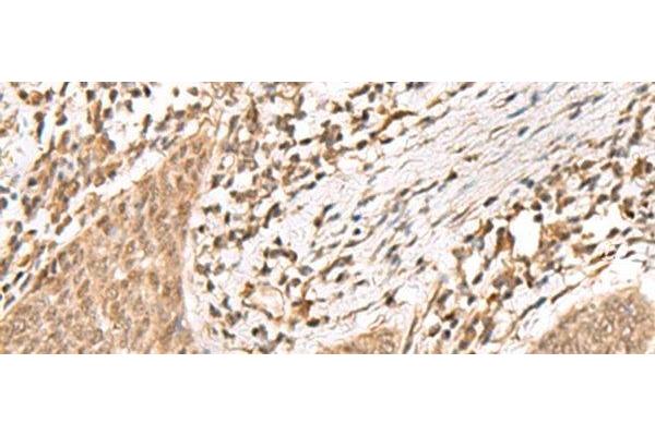 KDM2A antibody