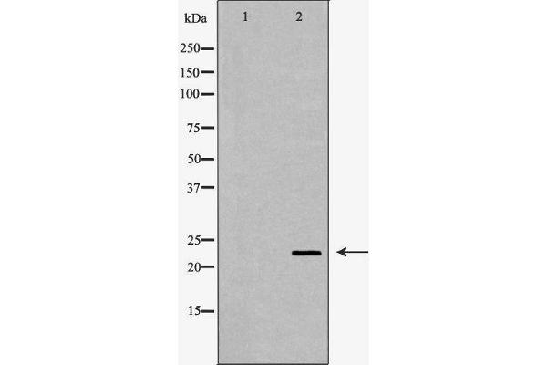 CRYbB2 antibody  (Internal Region)
