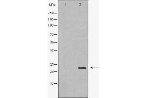 Western blot analysis of extracts of mouse eye, using CRYBB2 antibody.