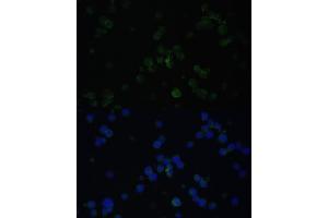 Immunofluorescence analysis of Jurkat cells using CD3D antibody (ABIN3021813, ABIN3021814, ABIN3021815 and ABIN6215992) at dilution of 1:100. (CD3D antibody  (AA 22-105))