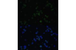 Immunofluorescence analysis of Jurkat cells using CD3D antibody (ABIN3021813, ABIN3021814, ABIN3021815 and ABIN6215992) at dilution of 1:100. (CD3D antibody  (AA 22-105))
