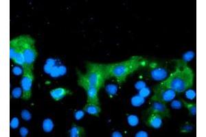 Anti-C20orf30 mouse monoclonal antibody (ABIN2455884) immunofluorescent staining of COS7 cells transiently transfected by pCMV6-ENTRY C20orf30 (RC201878). (C20orf30 antibody)