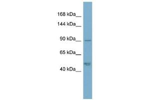 Plakophilin 2 antibody used at 1 ug/ml to detect target protein. (Plakophilin 2 antibody  (N-Term))