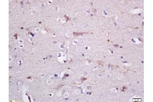 Formalin-fixed and paraffin embedded rat brain labeled with Rabbit Anti-GADD34 Polyclonal Antibody, Unconjugated (ABIN2174278) at 1:200 followed by conjugation to the secondary antibody and DAB staining (GADD34 antibody  (AA 401-500))