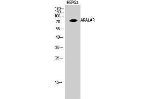 Western Blotting (WB) image for anti-Solute Carrier Family 25 (Mitochondrial Carrier, Aralar), Member 12 (Slc25a12) (Internal Region) antibody (ABIN3183346) (SLC25A12 antibody  (Internal Region))