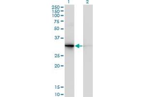 Western Blot analysis of PDYN expression in transfected 293T cell line by PDYN monoclonal antibody (M01), clone 2E12. (PDYN antibody  (AA 205-254))