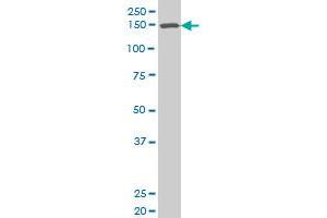 SMARCC1 polyclonal antibody (A01), Lot # 051012JC01 Western Blot analysis of SMARCC1 expression in SJCRH30 . (SMARCC1 antibody  (AA 338-437))