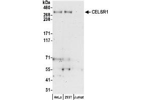 anti-Cadherin EGF LAG Seven Pass G-Type Receptor 1 (CELSR1) (AA 2775-2825) antibody