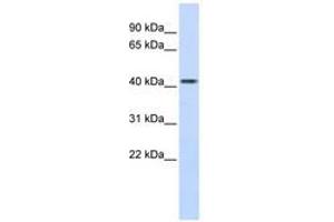 Image no. 1 for anti-Carboxypeptidase B2 (Plasma) (CPB2) (AA 324-373) antibody (ABIN6740831) (CPB2 antibody  (AA 324-373))