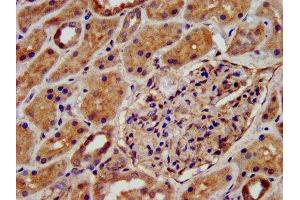 IHC image of ABIN7145029 diluted at 1:500 and staining in paraffin-embedded human kidney tissue performed on a Leica BondTM system. (KCNJ8 antibody  (AA 299-424))