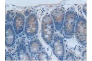 IHC-P analysis of Rat Intestine Tissue, with DAB staining. (CEACAM1 antibody  (AA 36-145))