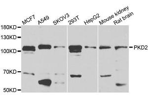 Western blot analysis of extracts of HEK-293 cell line, using PKD2 antibody. (PKD2 antibody  (AA 240-410))