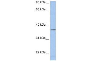 LDHAL6B antibody used at 1 ug/ml to detect target protein. (LDHAL6B antibody  (Middle Region))