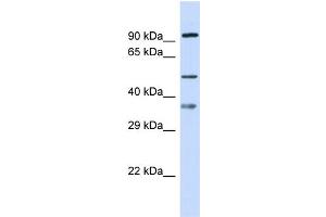 Host: Rabbit Target Name: SGSH Sample Type: 721_B Whole Cell lysates Antibody Dilution: 1.