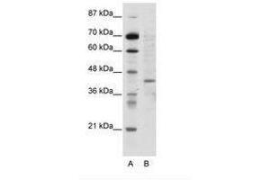 Image no. 1 for anti-Ring Finger Protein 1 (RING1) (N-Term) antibody (ABIN202445) (RING1 antibody  (N-Term))
