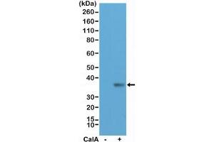 Western blot testing of lysate from human HeLa cells, untreated (-) or treated (+) with Calyculin A (CalA), with recombinant phospho-EIF2A antibody at 1:200 dilution. (Recombinant EIF2A antibody  (pSer51))