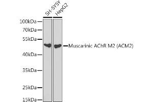 Western blot analysis of extracts of various cell lines, using Muscarinic AChR M2  antibody (ABIN3022148, ABIN3022149, ABIN3022150 and ABIN6218631) at 1:1000 dilution. (Muscarinic Acetylcholine Receptor M2 antibody  (AA 208-388))