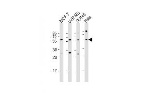 All lanes : Anti-RGS3 Antibody (N-Term) at 1:1000 dilution Lane 1: MCF-7 whole cell lysate Lane 2: U-87 MG whole cell lysate Lane 3: D whole cell lysate Lane 4: Hela whole cell lysate Lysates/proteins at 20 μg per lane. (RGS3 antibody  (AA 273-307))