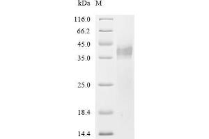 Kallikrein 5 (KLK5) (AA 68-294) protein (His tag)