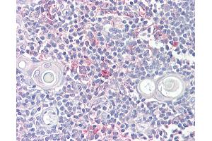 Anti-LITAF antibody IHC of human thymus. (LITAF antibody  (AA 51-64))