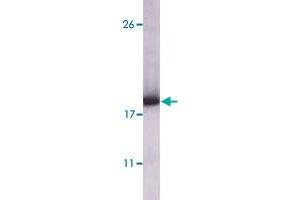 Western blot analysis using DDR2 monoclonal antibody, clone 3B11E4  against truncated DDR2 recombinant protein.