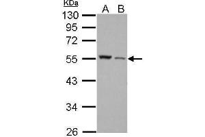 WB Image Desmin antibody detects DES protein by Western blot analysis. (Desmin antibody)