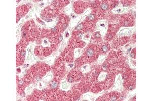 Formalin-fixed and paraffin-embedded H. (MT-ND5 antibody  (C-Term))