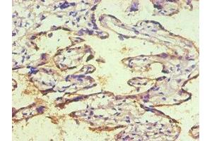 Immunohistochemical of paraffin-embedded human placenta tissue using ABIN7140934 (2E11-2B5) at dilution of 1:200. (CD59 antibody)