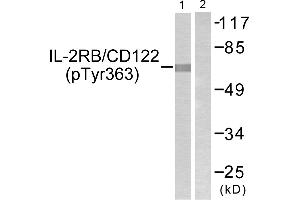 Western blot analysis of extracts from COS7 cells, using IL-2Rβ/CD122 (Phospho-Tyr364) antibody. (IL2 Receptor beta antibody  (pTyr364))