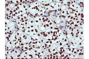 Image no. 3 for anti-THUMP Domain Containing 1 (THUMPD1) antibody (ABIN1501384) (THUMPD1 antibody)