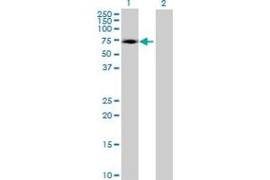 Western Blot analysis of ZNF449 expression in transfected 293T cell line by ZNF449 MaxPab polyclonal antibody. (ZNF449 antibody  (AA 1-518))