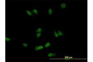 Immunofluorescence of monoclonal antibody to CSE1L on HeLa cell. (Exportin 2 antibody  (AA 872-971))