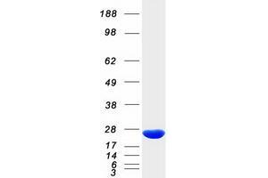Western Blotting (WB) image for Ferritin, Heavy Polypeptide 1 (FTH1) protein (Myc-DYKDDDDK Tag) (ABIN2721020)